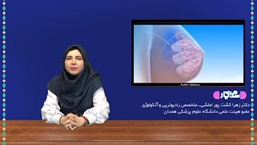 سرطان شایع در زنان