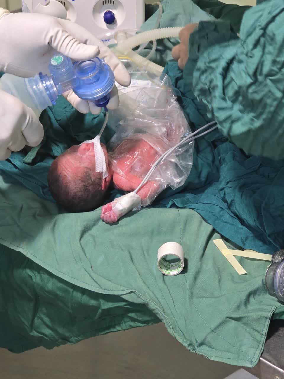 چشمان زیبای نوزاد یک بیمار باردار در مرکز آموزشی درمانی شهید بهشتی به‌ جهان گشوده شد